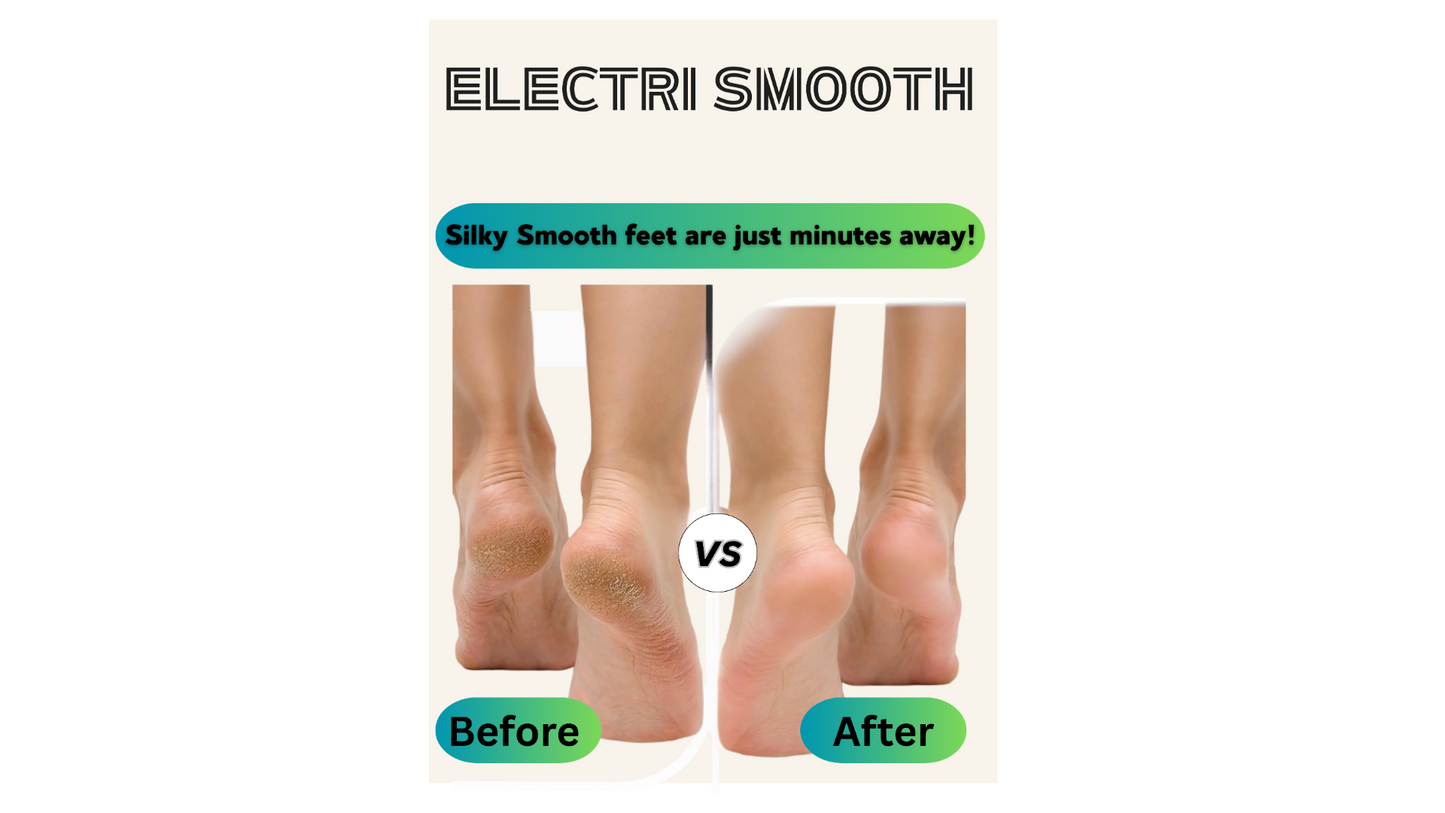 Electric Callus Remover.