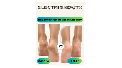 Electric Callus Remover.